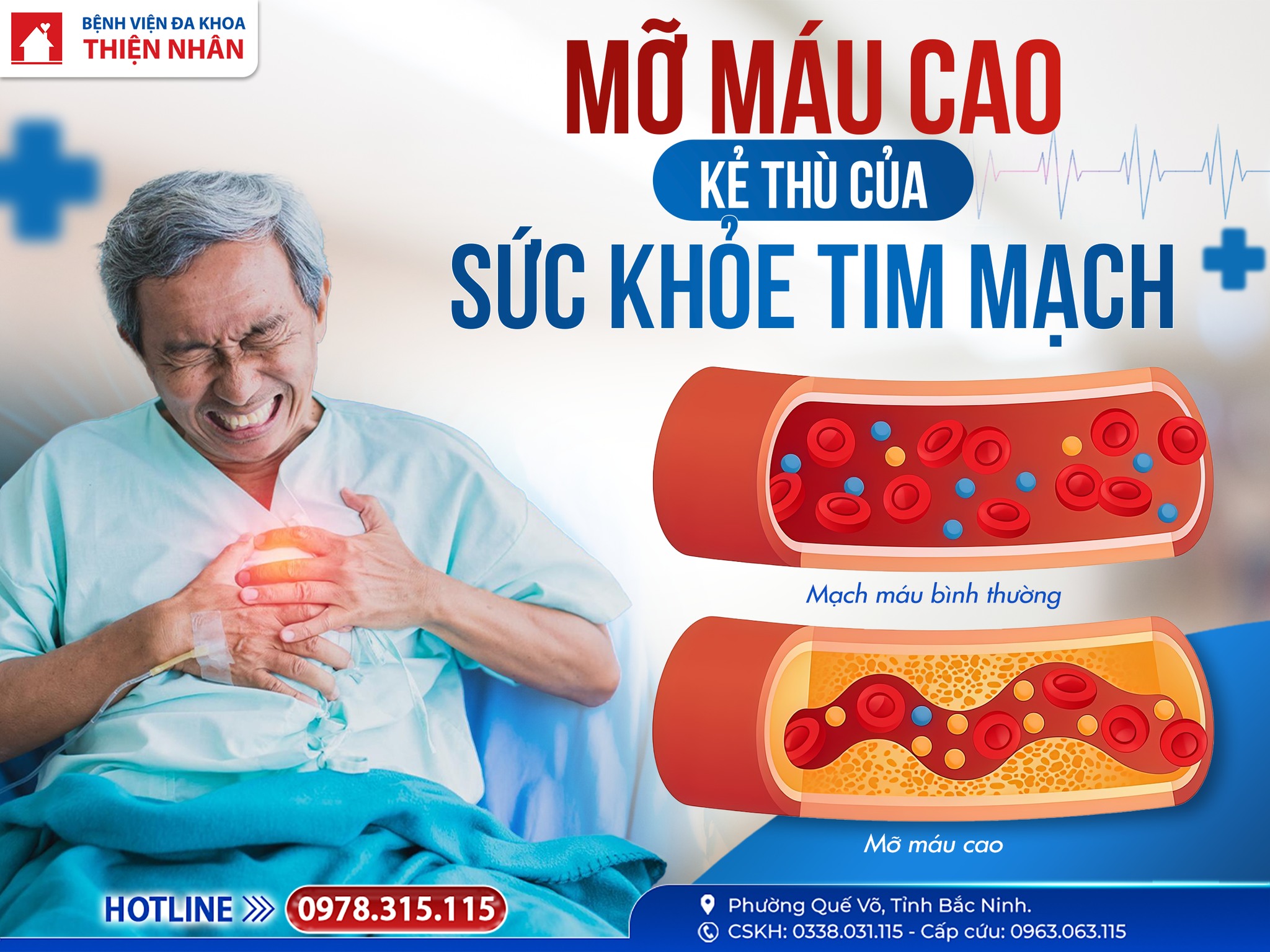 https://benhvienthiennhan.com/mo-mau-cao-–-ke-thu-tham-lang-gay-dot-quy-va-nhoi-mau-co-tim